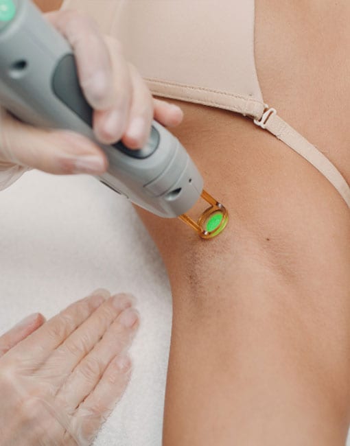 hair-removal lazer hair removal